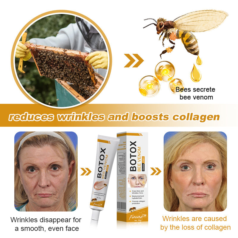 (✅🎁Made and shipped from Canada👨⚕️) Furzero™ Botox Bee Venom Wrinkle Removal Cream- LAST DAY 70% OFF