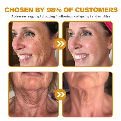 (✅🎁Made and shipped from Canada👨‍⚕️) Furzero™ Botox Bee Venom Wrinkle Removal Cream- LAST DAY 70% OFF